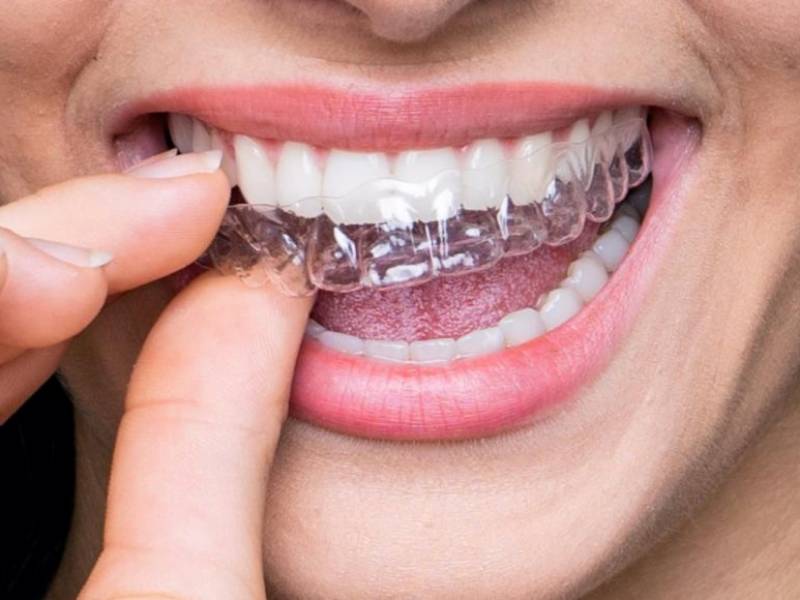 invisalign doctor site login