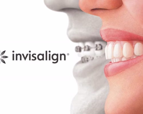 Invisalign Doctor Login