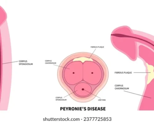 erigierter penis normale größe vergleich grafik